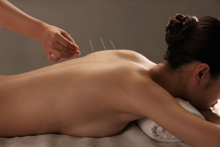 Dry needling Melbourne