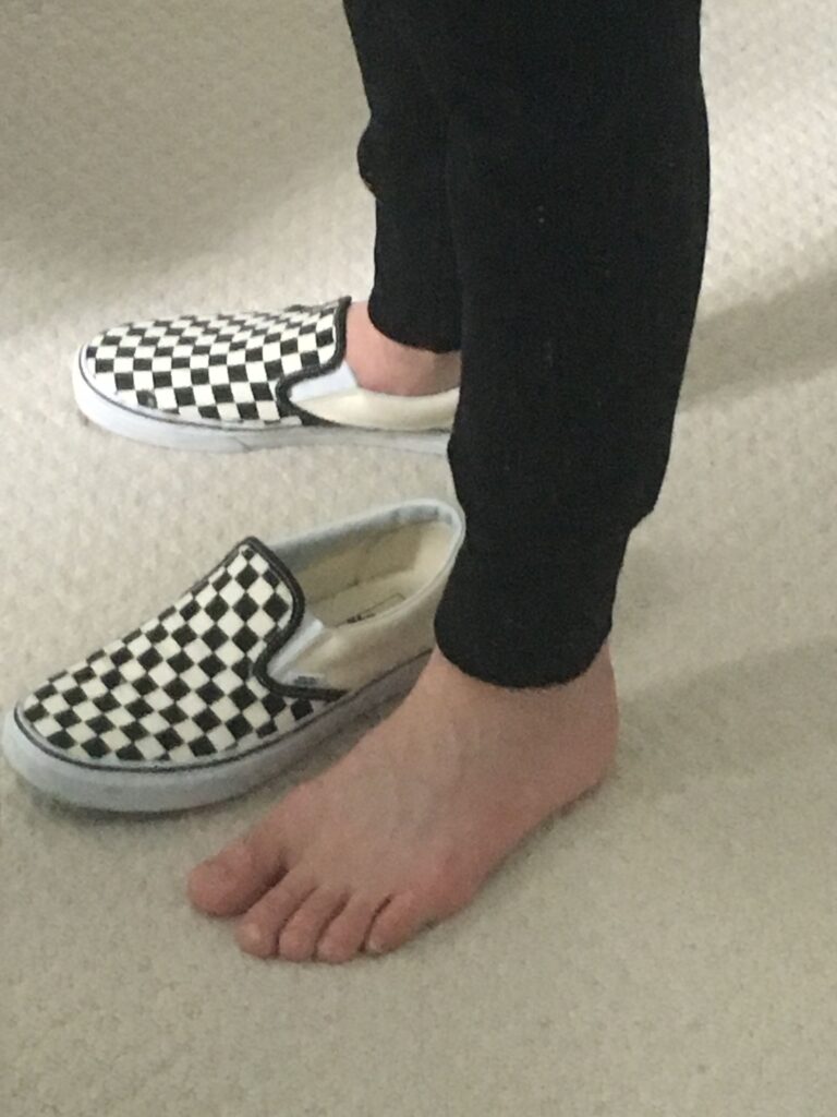 Bunion-Friendly Shoes