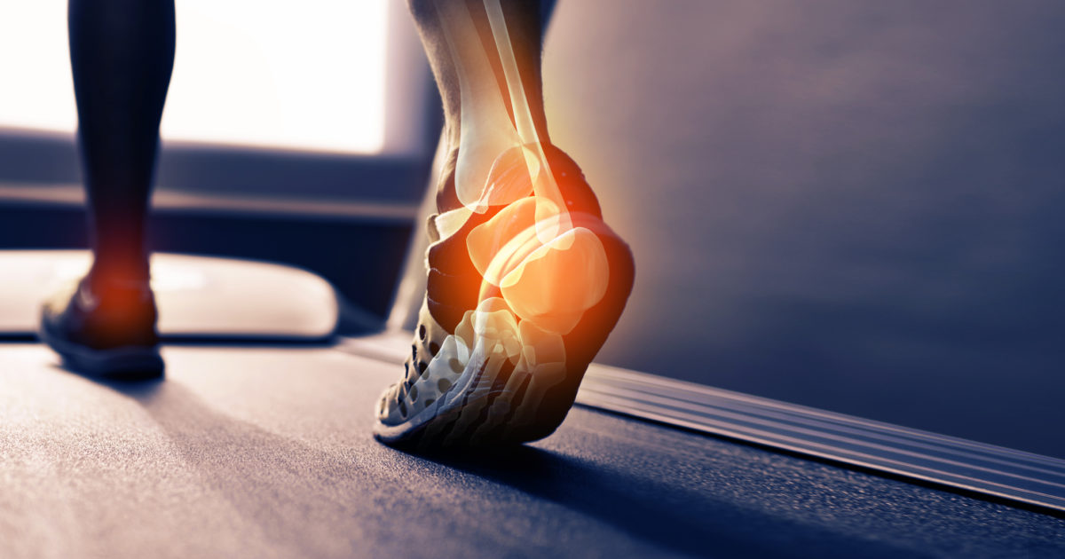 best shoes for ankle arthritis