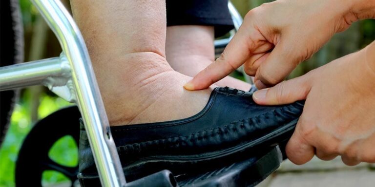 Best Shoes For Swollen Ankles And Feet